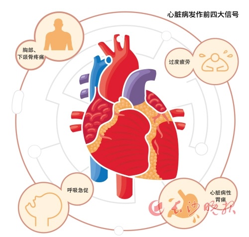 冠心病最新圖像研究，診斷與治療進(jìn)展探索