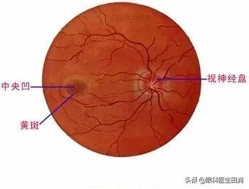 视网膜色素变性最新研究进展与前沿治疗方法探索